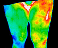 thermography iowa mend